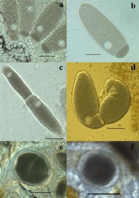  Gregarina: Un Parassita Microscopico con una Vita Sociale Complessa!