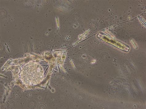  Reticulomyxa - Un piccolo gigante del mondo microscopico che striscia e si nutre con una strategia sorprendentemente intelligente!